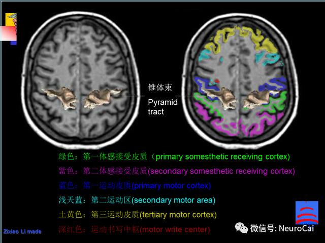 大脑结构图及功能图，人类大脑十大三维解剖图（脑局部解剖与功能图谱）