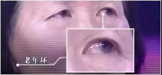 耳珠是哪个部位，耳朵长痣的位置图解（身体好不好，看“脸”就知道）