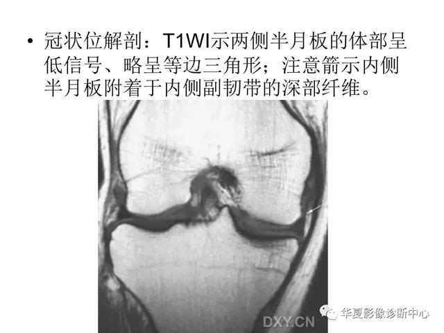 膝关节解剖结构图，膝盖解剖图示意图（膝关节MRI之正常解剖综述）