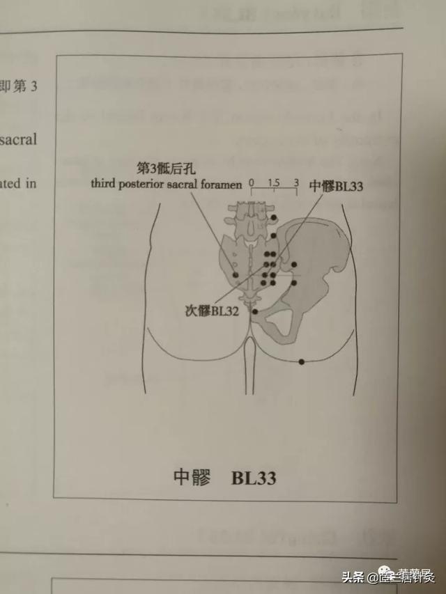 八髎准确位置图作用功效，八髎穴位位置图和作用（犹抱琵琶半遮面之八髎穴）