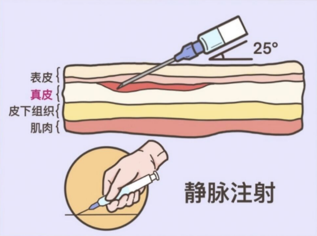 护士正确打针是怎么打的，平常看病打针，可是你知道吗