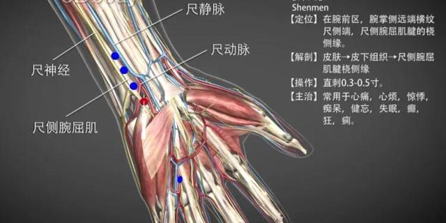 神门心皮质下定位，心神门皮质下位置图片（神门—清心泻火除烦）