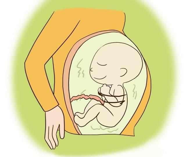 HL是胎儿的什么图片