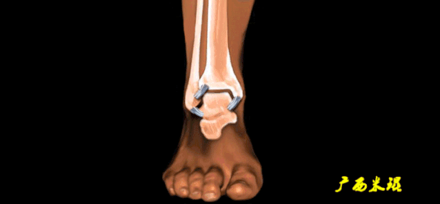 638_296gif 动态图 动图