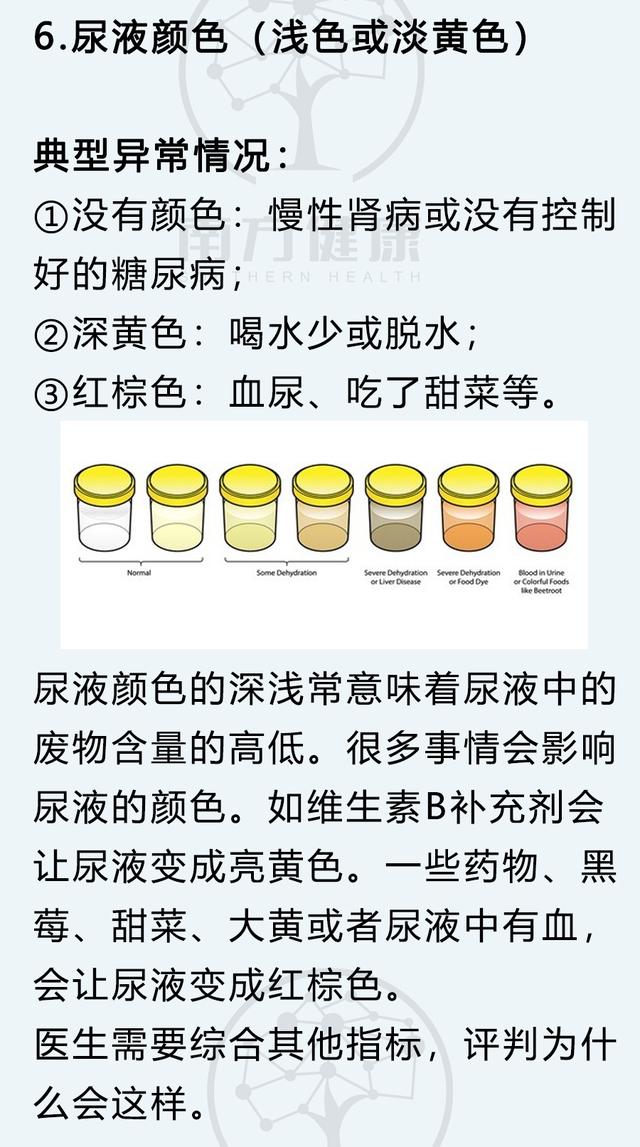 尿常规怎么检查，男性尿常规怎么看（5分钟判断身体健康）