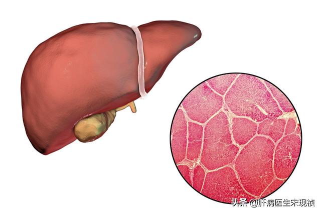 谷丙转氨酶偏高是什么原因，谷丙转氨酶偏高的原因是什么（一文详解谷丙转氨酶的那些事）