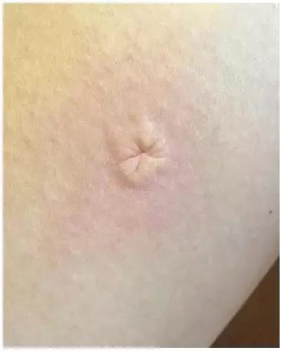 家有宝宝怎么驱蚊，家有宝宝驱蚊小妙招（真正有效的方法，只有这几种）