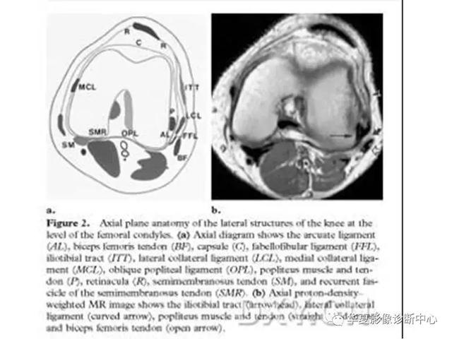 膝关节解剖结构图，膝盖解剖图示意图（膝关节MRI之正常解剖综述）