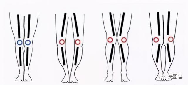 低帮鞋和高帮鞋有什么区别，低帮鞋和高帮鞋有什么区别图片（你适合“高帮鞋”还是“低帮鞋”）