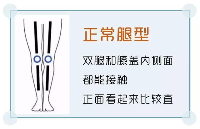 o型腿穿什么裤子不显得弯，o型腿的人适合穿什么裤子（专治腿粗、腿弯、屁股大）