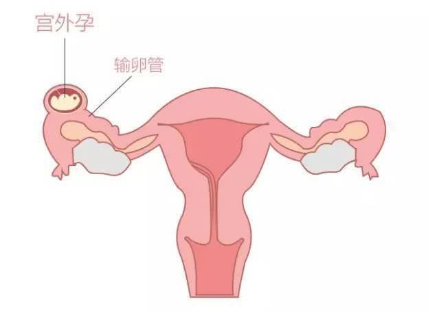 怀孕测试怎么看结果图片，测孕纸怎么看图解呢（若显示一深一浅）