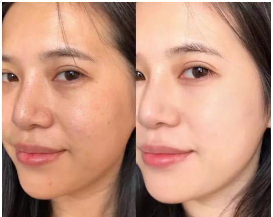 皮肤美白小窍门，皮肤美白小窍门是什么（改善肤色暗沉的4个小技巧）