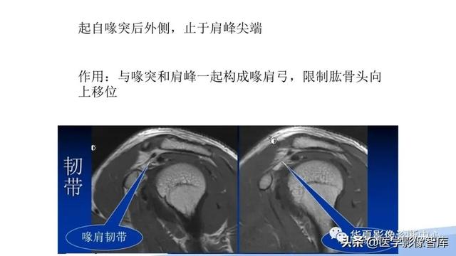 肩关节骨标志解剖图，全面掌握肩关节解剖
