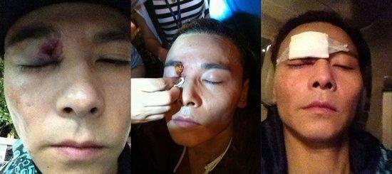 拍戏不要命！林志玲坠马骨折、张晋差点失明、彭于晏被踢关键部位