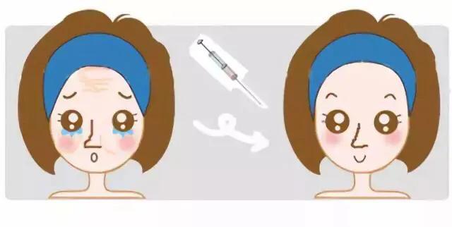 胶原蛋白填充泪沟维持多久，做胶原蛋白填充泪沟时间是多久（两年前注射胶原蛋白填充泪沟出现硬块怎么办）