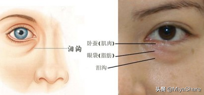 一年多没用「眼霜」，我的细纹却变少了