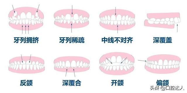 延长甲跟甲片有什么区别，延长跟贴甲片有什么区别（为什么有的人快）