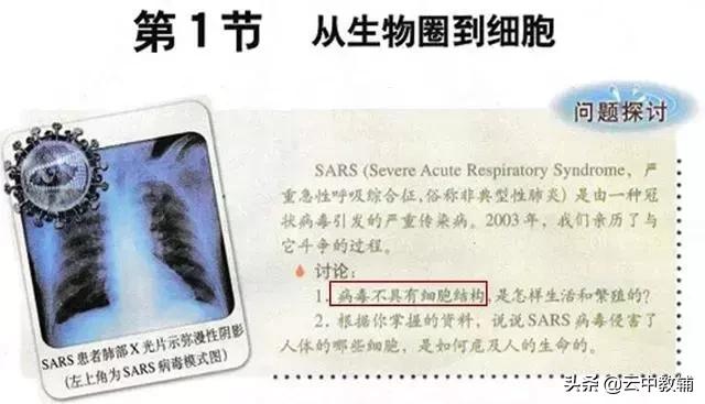 大肠杆菌菌落特征，大肠杆菌培养（一位高中生物老师分享对生物的理解）