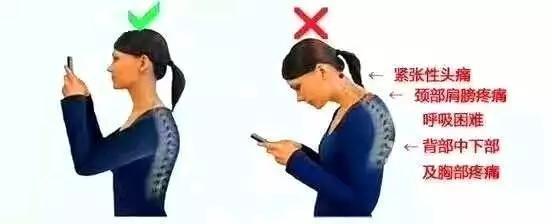 颈椎病三个按摩穴位，每十个人中就有一个颈椎有问题