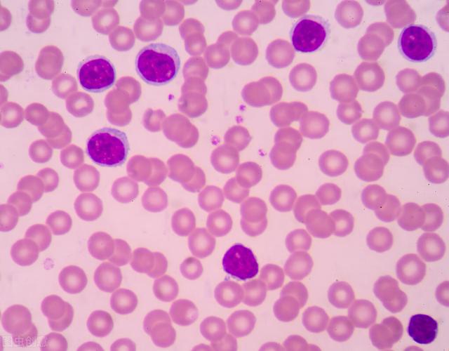 条件培养基（细胞培养需注意哪些环境因素和条件呢）