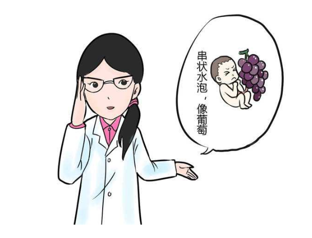 葡萄胎图片，女子怀“葡萄胎”两月不自知？
