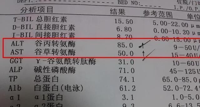 丙氨酸轉氨酶高怎麼快速降下來,丙氨酸轉氨酶是什麼(3種方法教你快速