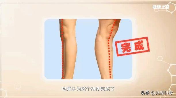 小拇指外翻怎么矫正，让你又丑又疼的拇外翻矫正方法在这里