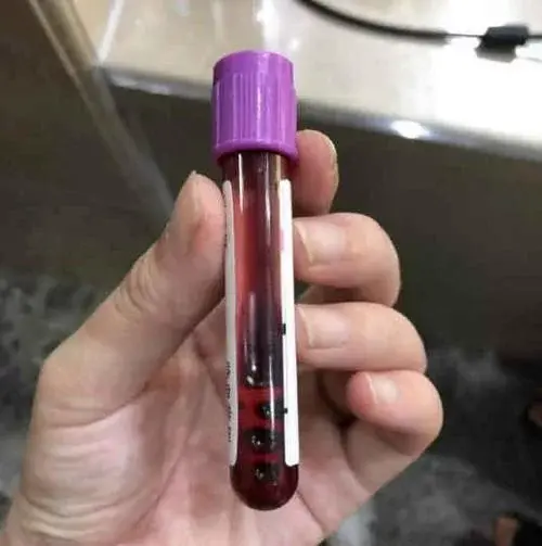 孕妇建档需要结婚证吗，怀孕建卡需要结婚证吗（孕妈提前了解怀孕建档攻略少走弯路）