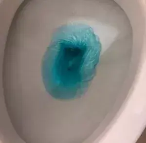 厕所黄污渍怎么去除，厕所发黄清洗的小妙招（保洁阿姨这个小妙招）