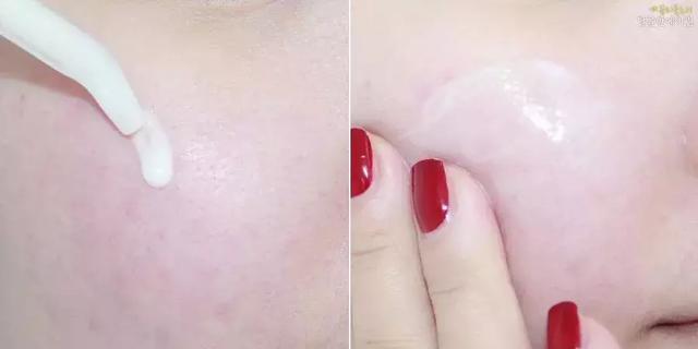 哪里有打美白针的，选对美白精华就能稳赢（哪里有美白针可以打）