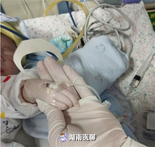 胎儿全身水肿成功案例（孕产妇紧急剖宫产诞下）