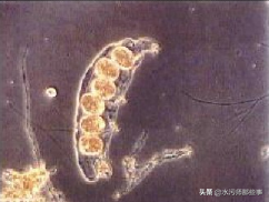 微生物镜检标准是多少，污水处理厂微生物镜检流程与污泥活性分析总结