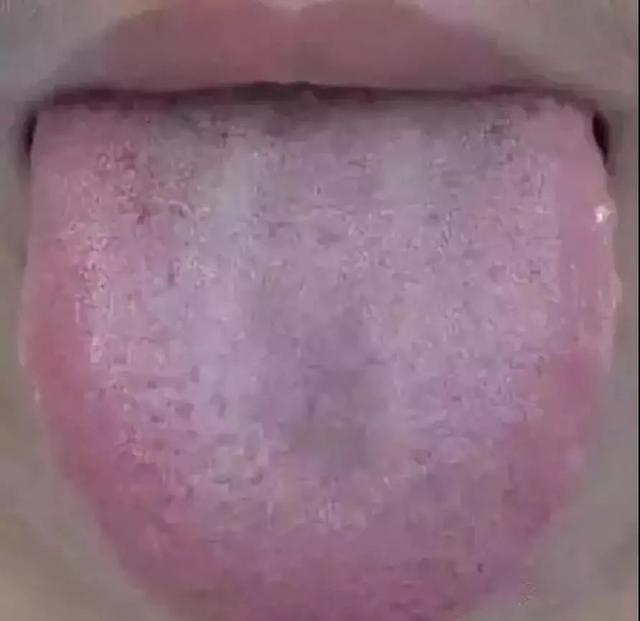 健康的舌头图片，如何判断自己的舌头健康状况（五脏在舌头均有反射区）