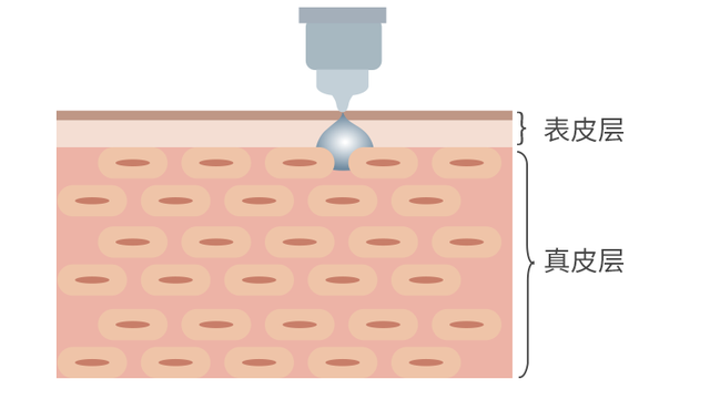 水光针的主要功效和副作用，美白水光针的主要功效和副作用（再高级的护肤品都是徒劳的）