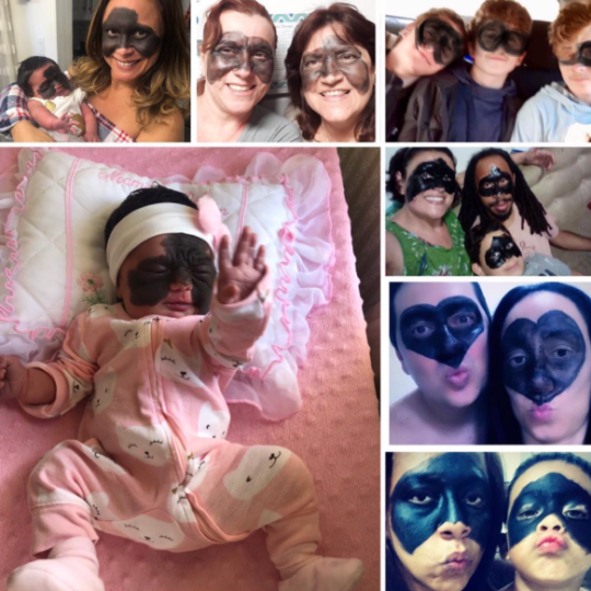 光敏印章怎么加油，原子公章和光敏章的区别（萌娃因“蝙蝠侠”胎记遭网暴）