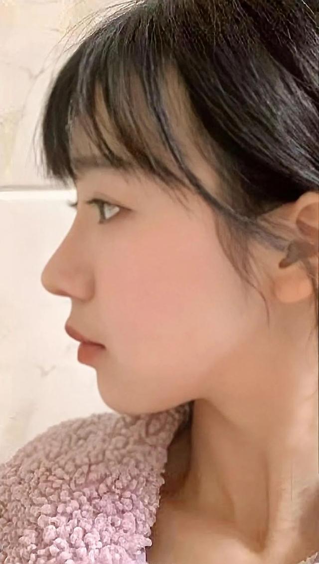 鼻梁的位置在哪，鼻梁的位置在哪个部位（她/他们的鼻子到底丑在哪儿）