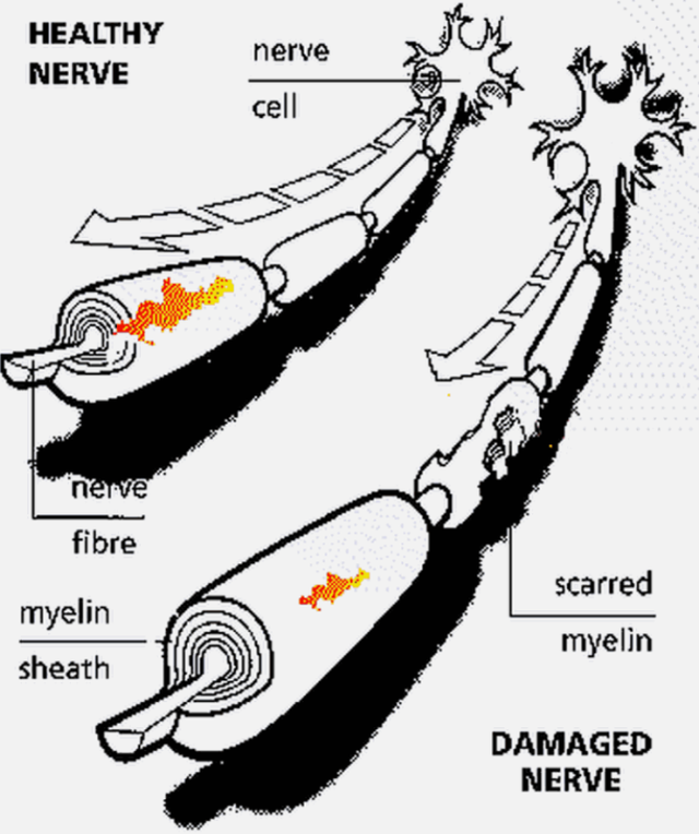 宇宙进化系统，为什么只有人类进化出高度发达的大脑
