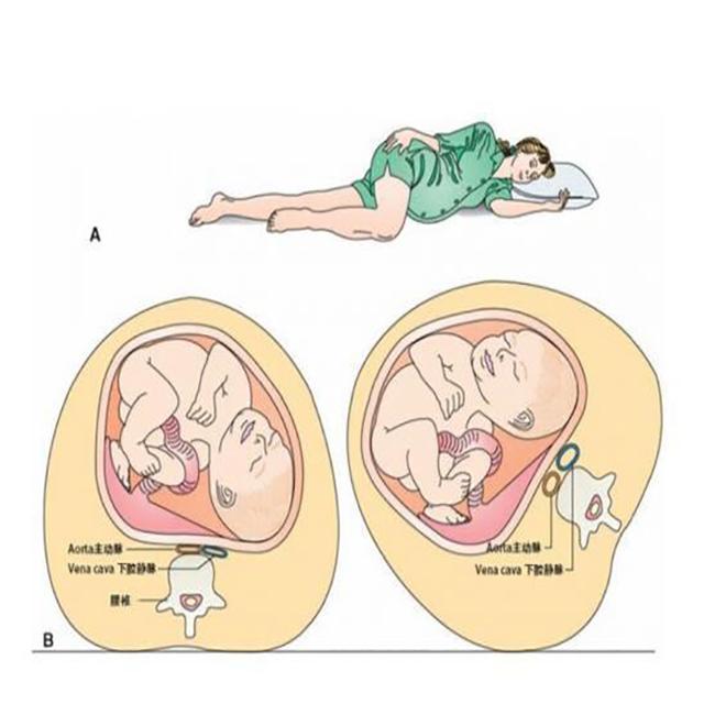 左侧躺为什么胎动更加明显，胎动为什么晚上很活跃（孕妈妈左侧卧睡）