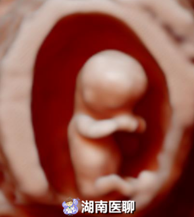 一维条码有什么用，孕检中除了二维、三维