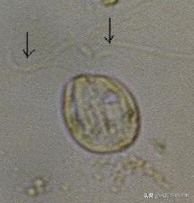 微生物镜检标准是多少，污水处理厂微生物镜检流程与污泥活性分析总结