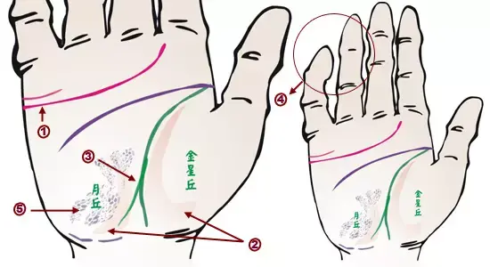 掌纹诊病实用图谱，看看你的掌纹：预示者不同疾病（可以诊断肝癌、糖尿病、高血压、妇科病、脑溢血）