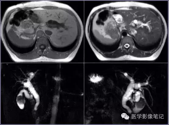 吃赖尿虾的好处，孕妇可以吃濑尿虾吗中期（这8种肝脏变异）