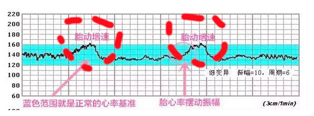 胎心监护图怎么看，看胎心监护图时，记住这5个关键数值！（自己就能了解胎儿的健康情况）