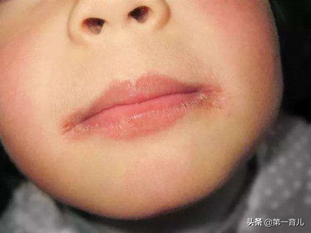 14款儿童唇膏中，喜宝、迪士尼、美宝莲儿童唇膏检出可能致癌物