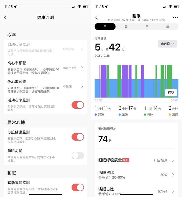 测血压手表(哪款手表可以测血压)