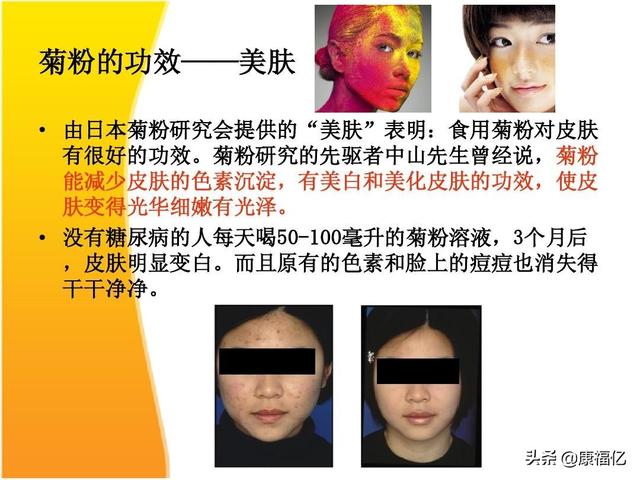 什么是菊粉，康福亿健康小知识：菊粉是什么