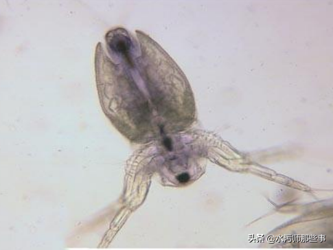 微生物镜检标准是多少，污水处理厂微生物镜检流程与污泥活性分析总结