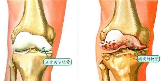 六千步约多少公里，6千步相当于多少公里（医生：每天走路1万步是错的）