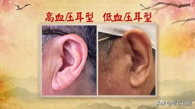 耳皮读什么意思是什么，耳朵皮读什么（降压、健脑、补肾精……别错过）