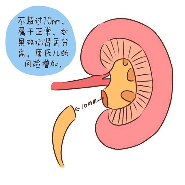 10分钟看懂四维，检查报告的这几点能看懂